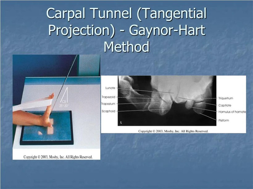 Carpal tunnel x ray positioning