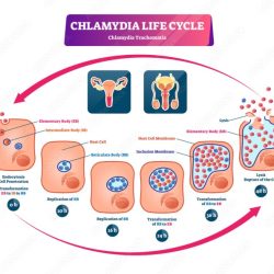 Label the stages and structures of the chlamydia life cycle